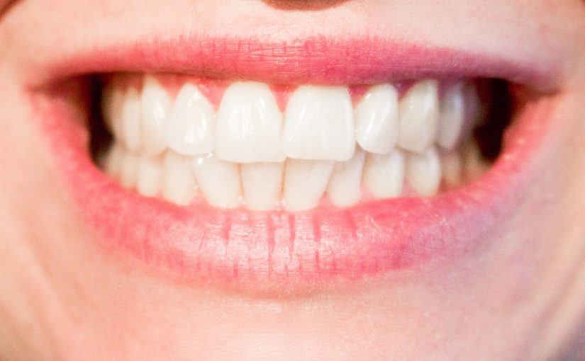 Obecna technologia wykorzystywana w salonach stomatologii estetycznej zdoła spowodować, że odzyskamy piękny uśmiech.